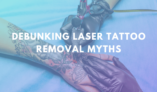 Debunking Laser Tattoo Removal Myths