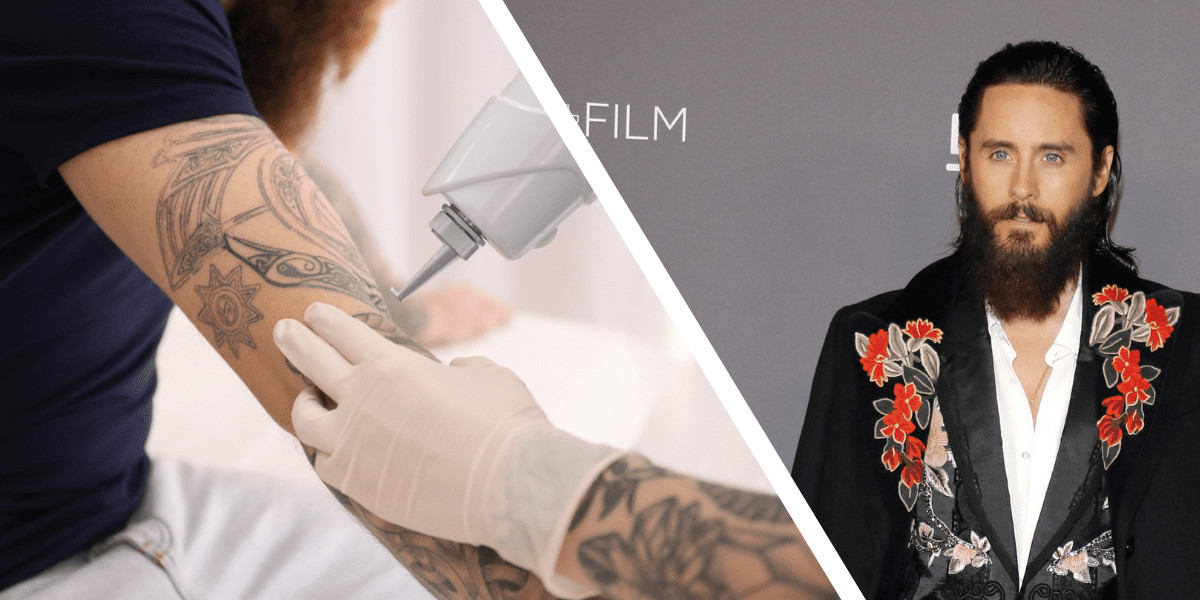 Jared Leto Seeks Tattoo Removal after Filming _The Joker_
