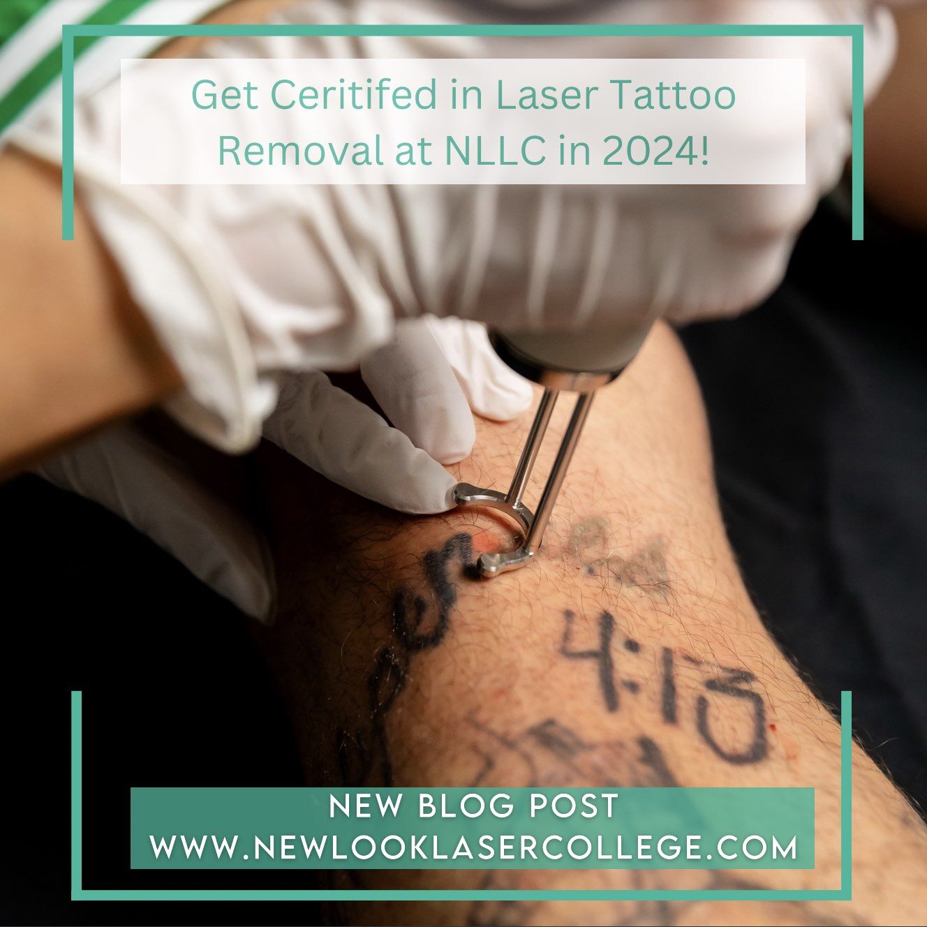 get certified in laser tattoo removal by the best at new look laser college in 2024 Get Certified in Tattoo Removal at New Look Laser College | 2024 Schedule