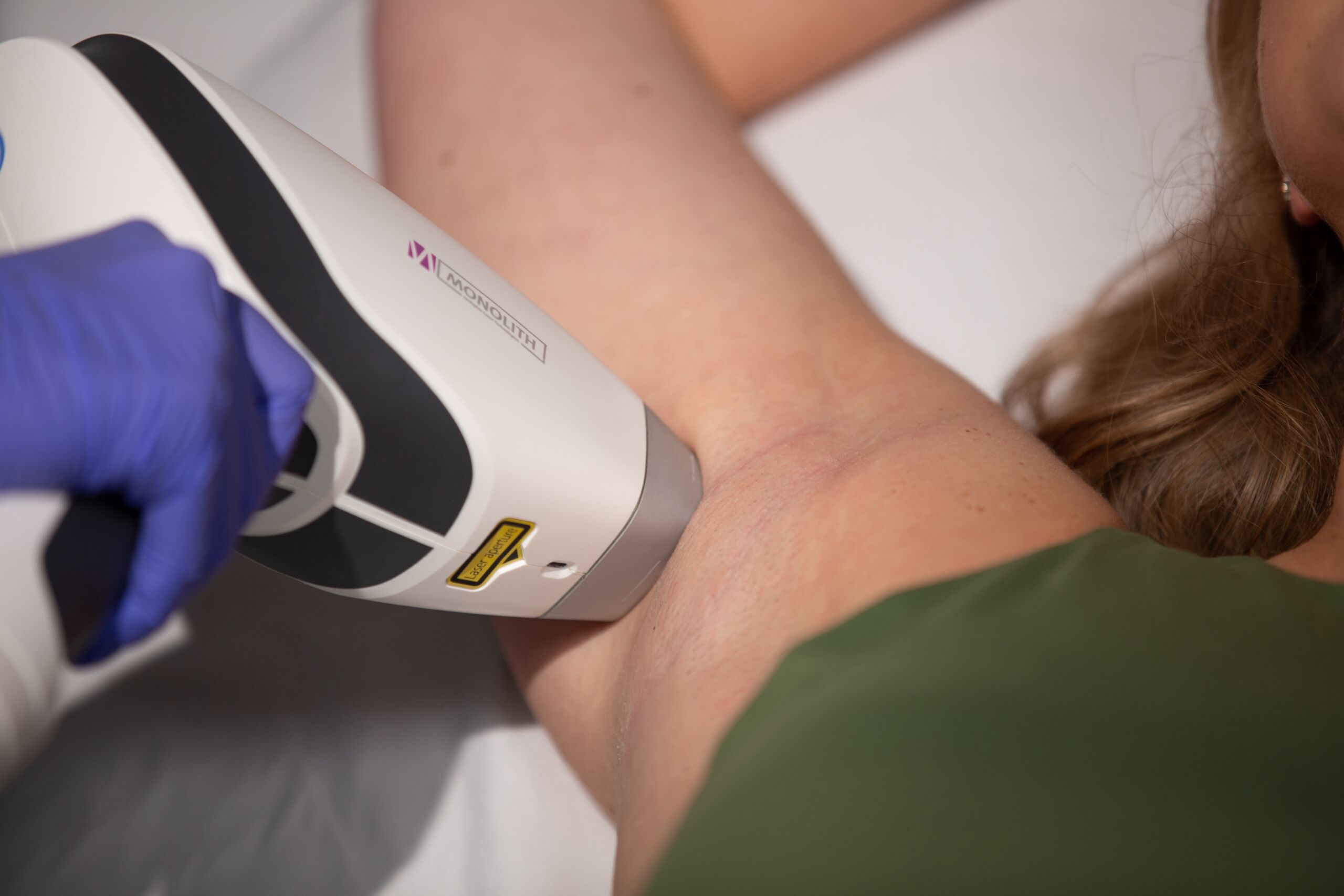 laser hair removal training - underarm underarm laser hair removal treatment